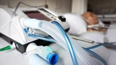Imagem ilustrativa de Calibração de ventilador pulmonar